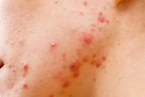 睡衣,床单,枕巾该多久清洗一次?超过这个时间,螨虫会