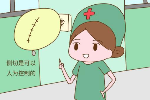 撕裂和侧切哪个恢复快 什么情况下才会侧切-八福集