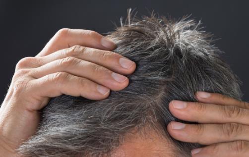 导致头发变白的坏习惯 小习惯就能拥有一头乌黑秀发-八福集