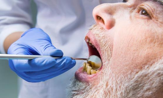 戴假牙并不是一劳永逸的事情 老人戴假牙的注意事项