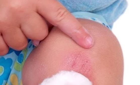 一不留神宝宝受伤了 父母镇定处理好方法推荐-八福集