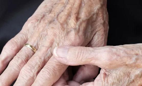 老年斑并不是老年人的专利 预防和延缓老年斑发生的食物-八福集