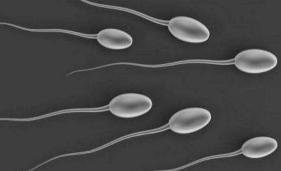 影响精子成活率的习惯 经常熬夜的男子记住要改一改-八福集