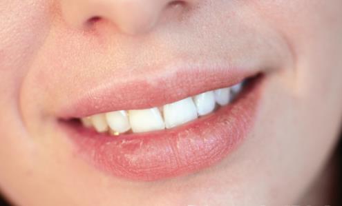 快来get唇部护理3不要法则 远离护唇六大护理误区