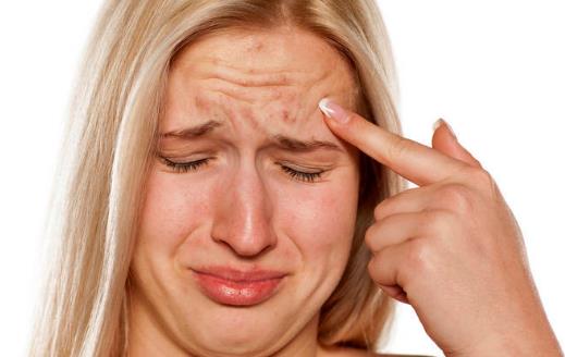 肌肤长痘痘 祛痘10大误区应避免-八福集