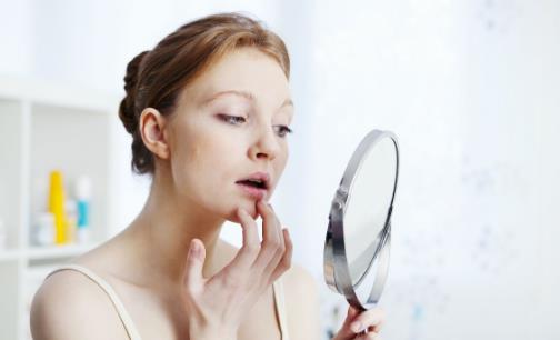 下巴长痘是什么原因造成的 天然祛痘祛印的方法分享-八福集
