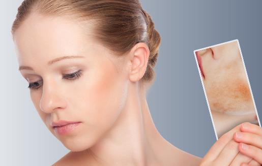 皮炎轻松解决方法 皮炎人群的日常护理法则-八福集