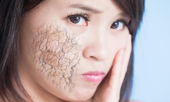 皮肤缺水的表现你中招了吗 给皮肤正确补水还你水光肌-八福集