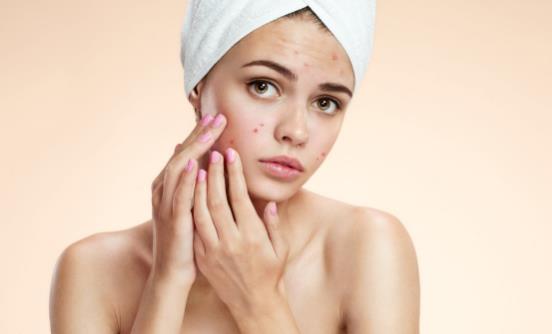 为何脸上容易长出痘痘 不同部位的痘痘有什么去除的好方法-八福集