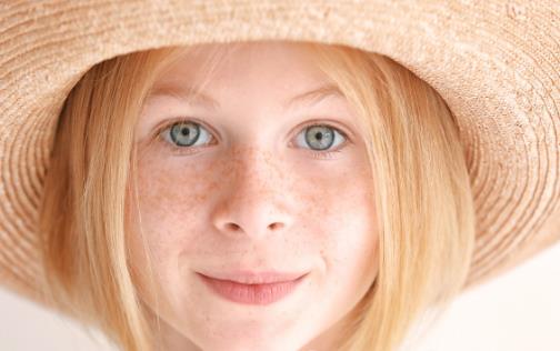 烦人的晒斑因何而来 祛斑首当其冲的就是防晒-八福集