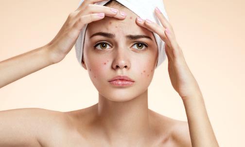 预防青春痘的日常方法 痤疮的正确饮食原则推荐-八福集