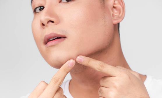 下巴长痘痘怎么办 治疗体表的痘痘要先排毒-八福集