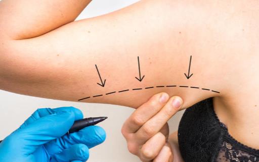 别怕长拜拜肉 坚持科学的运动七天告别拜拜袖-八福集