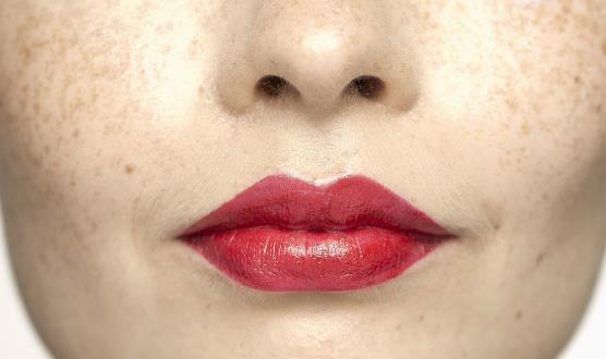 激光祛斑会不会反弹 适合激光祛斑的人群-八福集