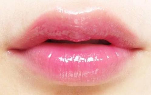 嘟嘟唇术后注意事项 漂亮的嘟嘟唇要结合自身基础-八福集