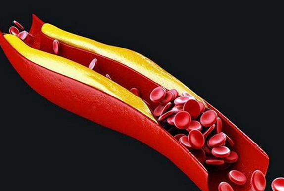 10种人不宜喝酸奶-八福集