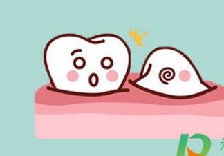 智齿横着长了拔掉难度大吗 智齿为什么会横着长-八福集